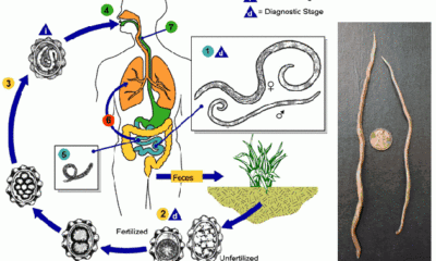 parasitos intestinales