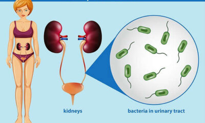 infeccion urinaria