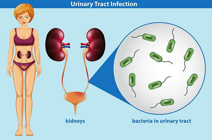 infeccion urinaria